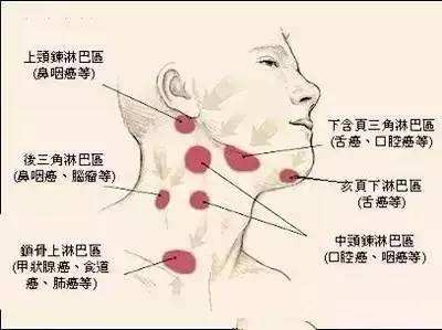 急性淋巴結(jié)炎