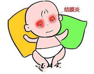 過敏性結膜炎